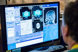 MRI MRI